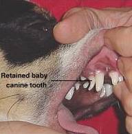 Retained Baby Canine Tooth